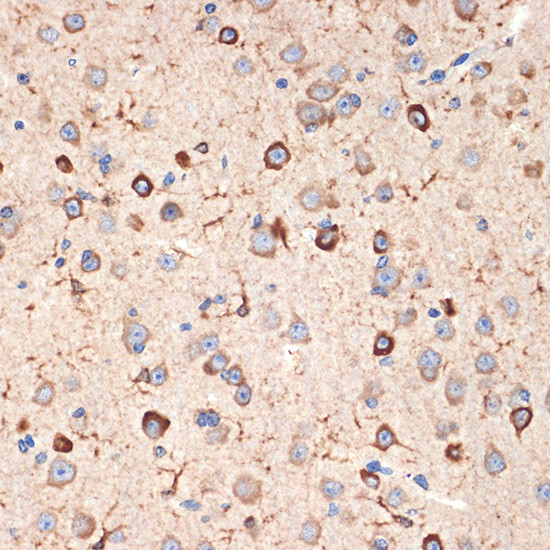 MSI2 Antibody in Immunohistochemistry (Paraffin) (IHC (P))