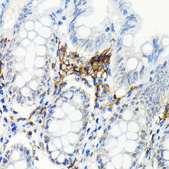HLA-DRB1 Antibody in Immunohistochemistry (Paraffin) (IHC (P))