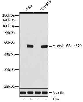Acetyl-p53 (Lys370) Antibody in Western Blot (WB)
