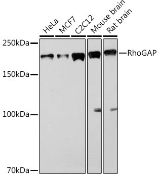 ARHGAP5 Antibody in Western Blot (WB)
