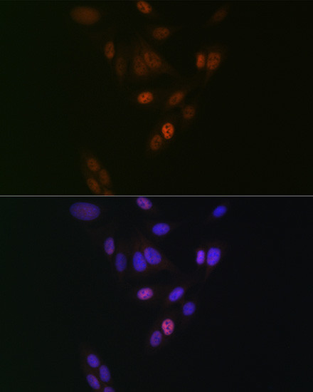 NUP153 Antibody in Immunocytochemistry (ICC/IF)