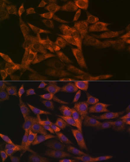 IRF6 Antibody in Immunocytochemistry (ICC/IF)