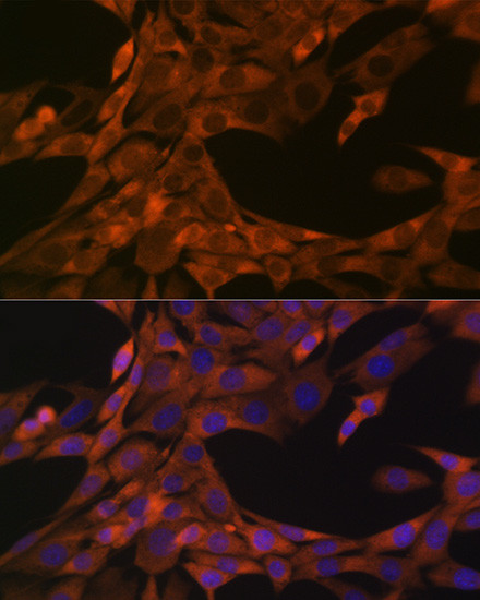 WFDC2 Antibody in Immunocytochemistry (ICC/IF)
