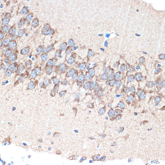 PAK3 Antibody in Immunohistochemistry (Paraffin) (IHC (P))
