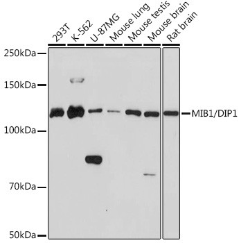 MIB1 Antibody in Western Blot (WB)
