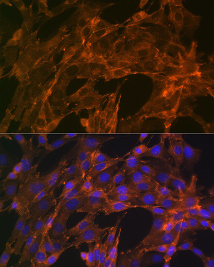 alpha Actinin 4 Antibody in Immunocytochemistry (ICC/IF)
