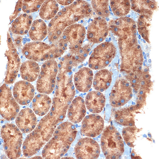 NEK6 Antibody in Immunohistochemistry (Paraffin) (IHC (P))