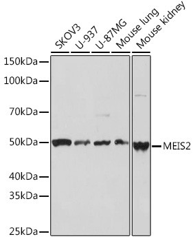 MEIS2 Antibody in Western Blot (WB)