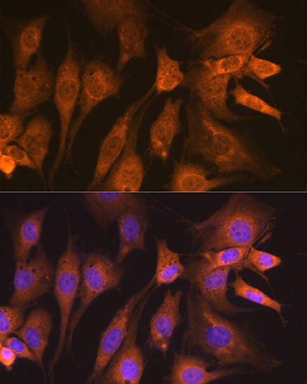 GUCY1B3 Antibody in Immunocytochemistry (ICC/IF)