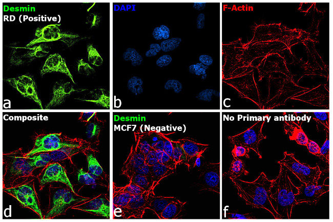 Desmin Antibody in Immunocytochemistry (ICC/IF)