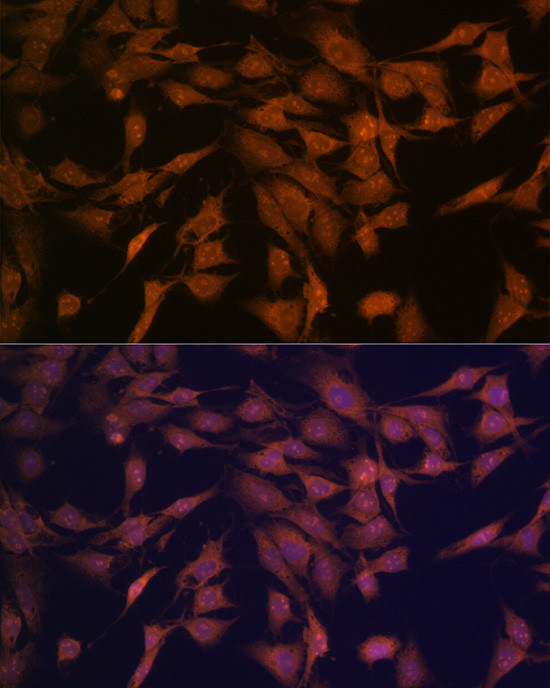 CENPC Antibody in Immunocytochemistry (ICC/IF)