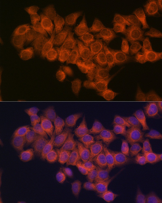 NDUFAF1 Antibody in Immunocytochemistry (ICC/IF)