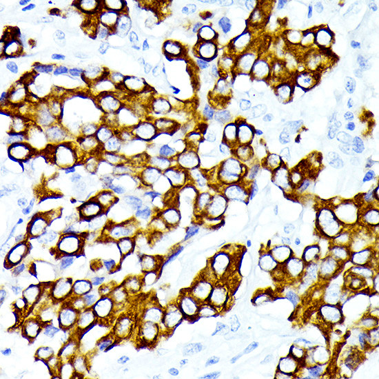 Cytokeratin 7 Antibody in Immunohistochemistry (Paraffin) (IHC (P))