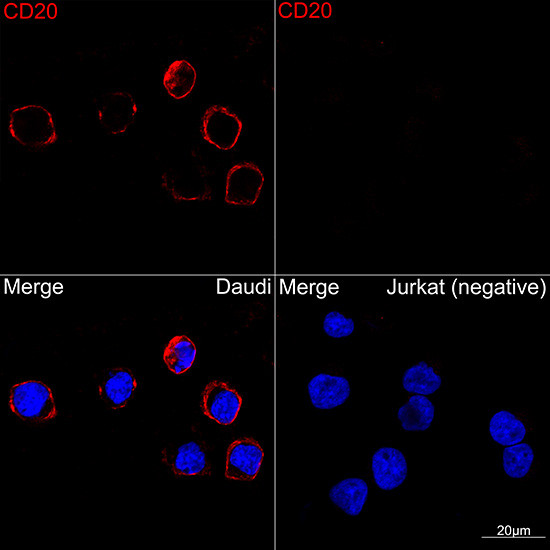 CD20 Antibody in Immunocytochemistry (ICC/IF)
