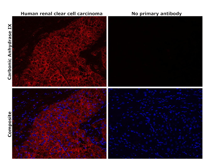 Carbonic Anhydrase IX Antibody in Immunohistochemistry (Paraffin) (IHC (P))
