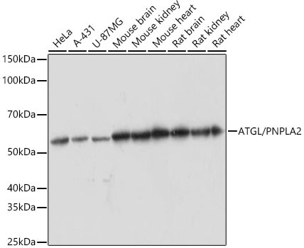 ATGL Antibody in Western Blot (WB)