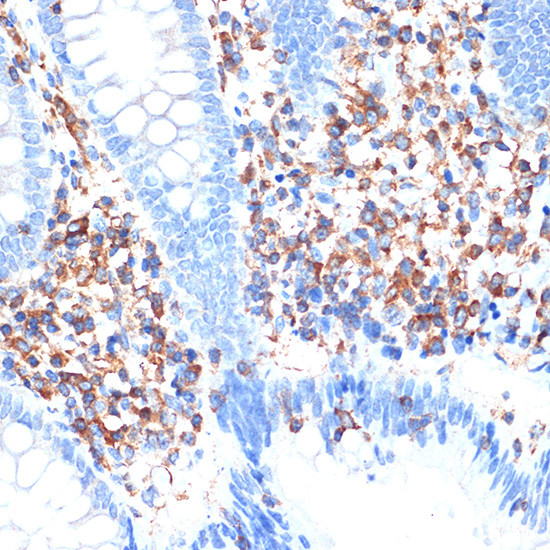ELMO1 Antibody in Immunohistochemistry (Paraffin) (IHC (P))