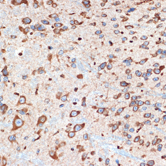 ADORA1 Antibody in Immunohistochemistry (Paraffin) (IHC (P))