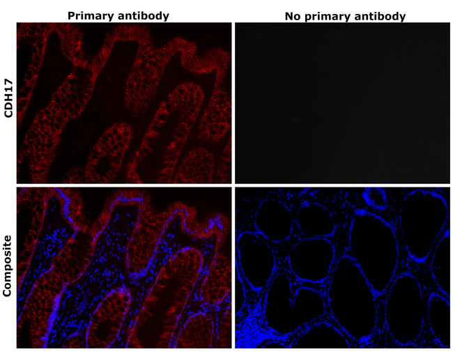 CDH17 Antibody in Immunohistochemistry (Paraffin) (IHC (P))