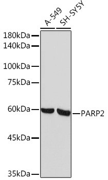 PARP2 Antibody in Western Blot (WB)