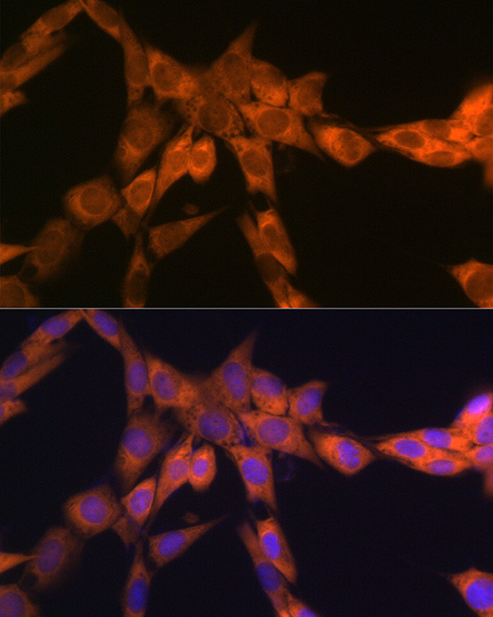 RPSA Antibody in Immunocytochemistry (ICC/IF)