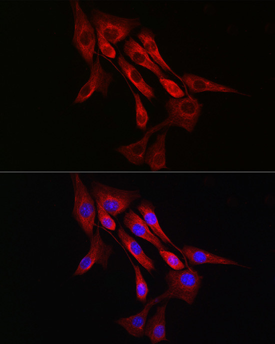 alpha Tubulin Antibody in Immunocytochemistry (ICC/IF)