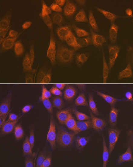SEC23B Antibody in Immunocytochemistry (ICC/IF)