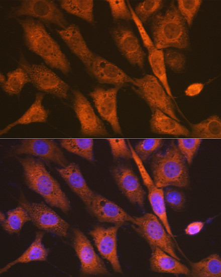 PEN2 Antibody in Immunocytochemistry (ICC/IF)