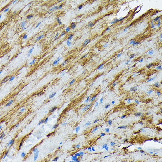 HSP20 Antibody in Immunohistochemistry (Paraffin) (IHC (P))