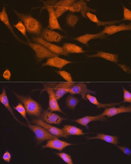 RPS6KB2 Antibody in Immunocytochemistry (ICC/IF)