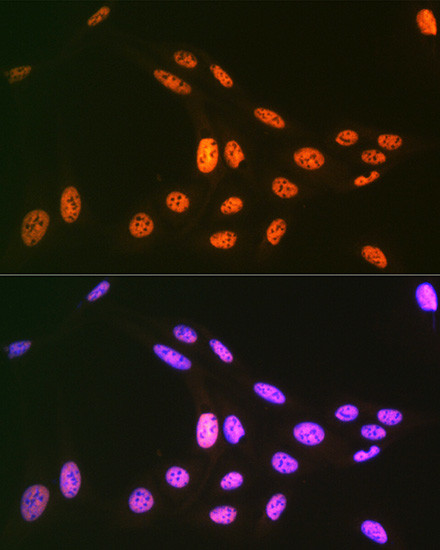 PRP19 Antibody in Immunocytochemistry (ICC/IF)