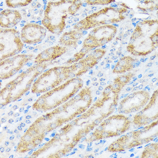 TIRAP Antibody in Immunohistochemistry (Paraffin) (IHC (P))