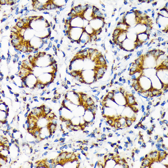 TOMM22 Antibody in Immunohistochemistry (Paraffin) (IHC (P))