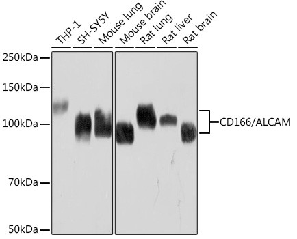 CD166 (ALCAM) Antibody in Western Blot (WB)