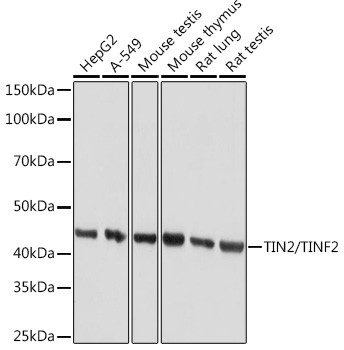 TIN2 Antibody in Western Blot (WB)