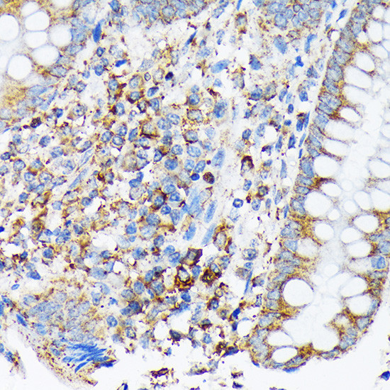 Cdc25B Antibody in Immunohistochemistry (Paraffin) (IHC (P))