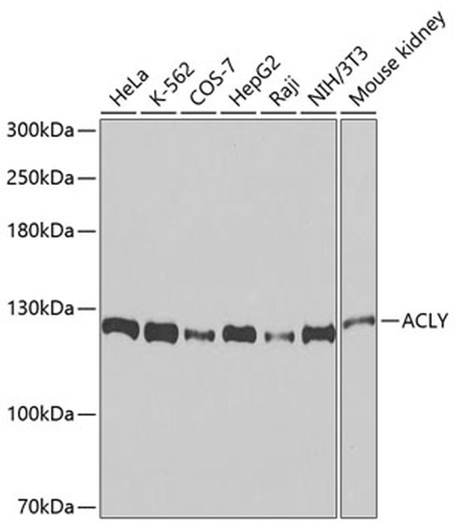 ATP Citrate Lyase Antibody in Western Blot (WB)