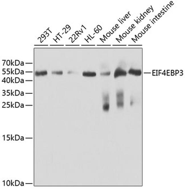 4E-BP3 Antibody in Western Blot (WB)