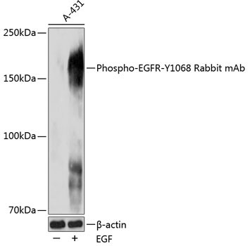 Phospho-EGFR (Tyr1068) Antibody in Western Blot (WB)