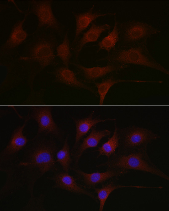 Phosphotyrosine Antibody in Immunocytochemistry (ICC/IF)