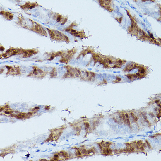 Phospho-ERK1/2 (Thr202, Tyr204) Antibody in Immunohistochemistry (Paraffin) (IHC (P))