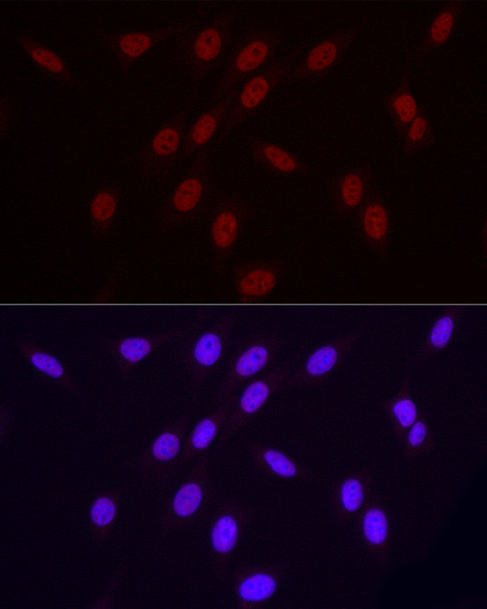 Phospho-POLR2A (Ser2) Antibody in Immunocytochemistry (ICC/IF)