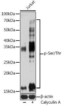Phosphoserine/threonine Antibody in Western Blot (WB)