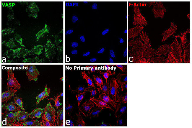 VASP Antibody in Immunocytochemistry (ICC/IF)