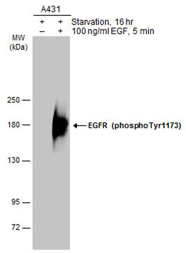 Phospho-EGFR (Tyr1173) Antibody in Western Blot (WB)