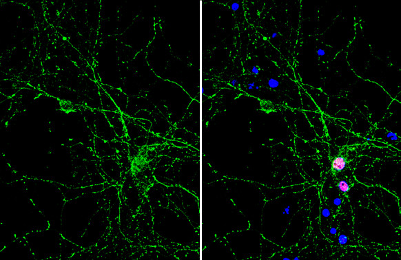 PGP9.5 Antibody in Immunocytochemistry (ICC/IF)