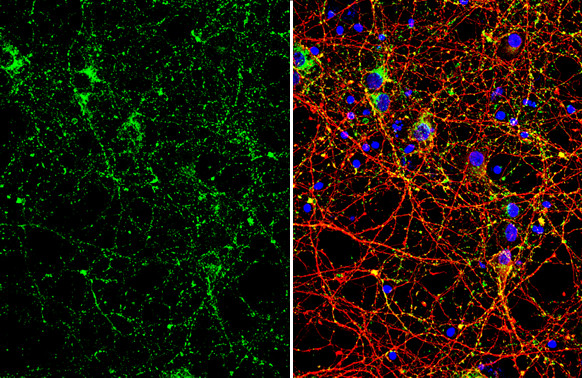 VAMP2 Antibody in Immunocytochemistry (ICC/IF)