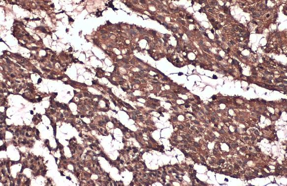 IKK beta Antibody in Immunohistochemistry (Paraffin) (IHC (P))