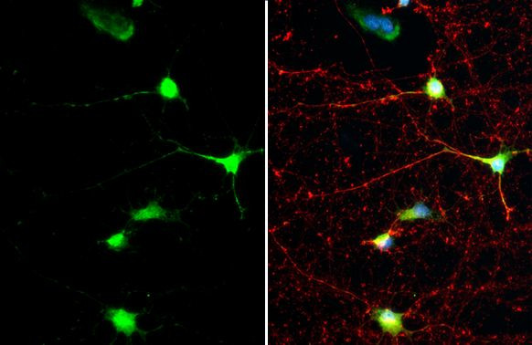 SMCR8 Antibody in Immunocytochemistry (ICC/IF)