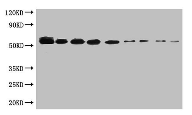 Sumo Tag Antibody in Western Blot (WB)
